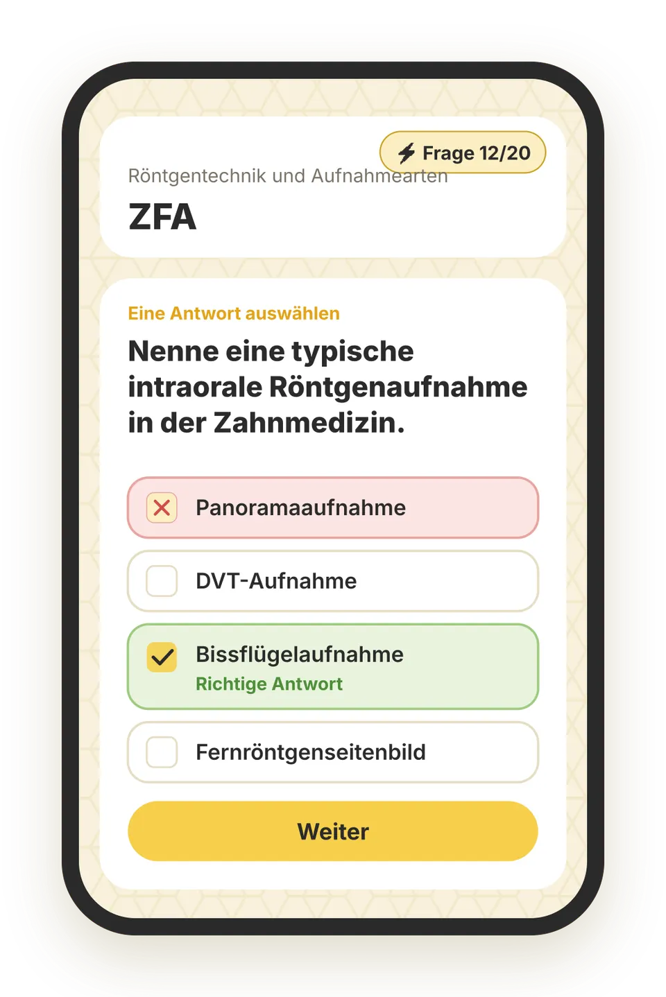Beispielfrage aus der beezubi-App für Zahnmedizinische Fachangestellte / Zahnmedizinischer Fachangestellter, Lernbereich Röntgentechnik und Aufnahmearten: „Nenne eine typische intraorale Röntgenaufnahme in der Zahnmedizin.“ – die richtige Antwort ist grün markiert.